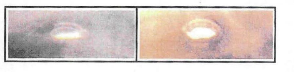 DOW-UAP-D166: two image crops reproduced in the MUFON "Human Interface" paper, each showing a small bright oval object. The paper says MUFON holds copies of x-rays that "may provide evidence of implants", describing objects "about the size of the tip of a pen" found in a 16-year-old female and a 76-year-old male; the document gives no source, date or analysis for the images.