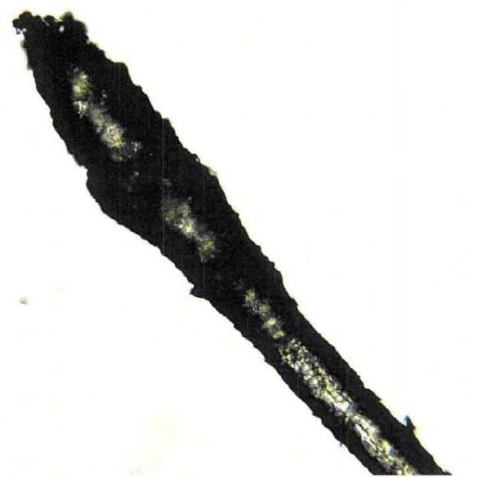 DOW-UAP-D174, Figure 12: Celestron LCD Digital Microscope Model #44340 image at 10x objective of a hair strand, which the caption says "indicates the presence of a hair follicle located on a strand which can be analyzed for nuclear DNA for species identification".